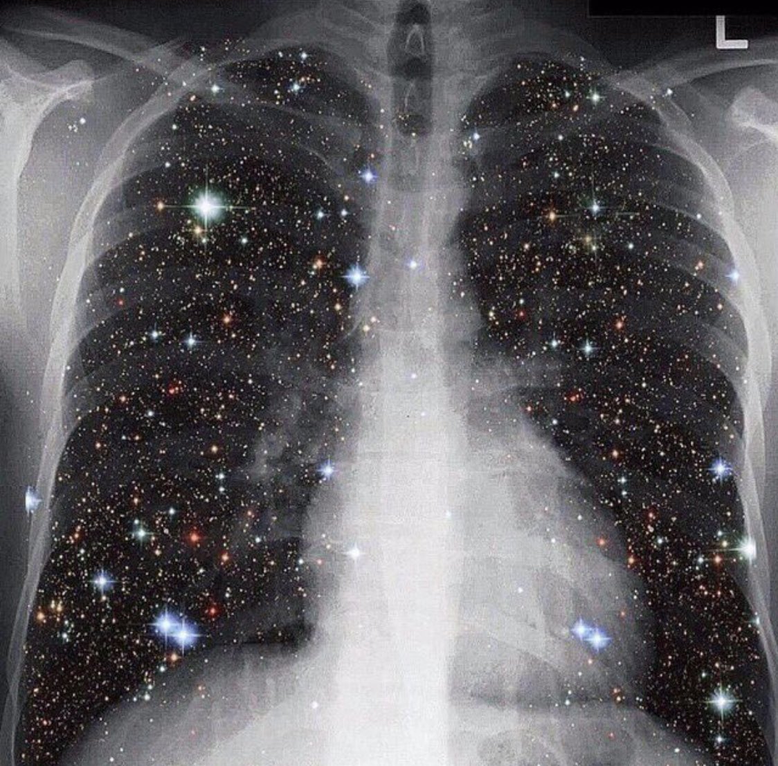Rad_uoh's tweet photo. دُمتم مشعّين بالعطاء ياعين الأطباء ☢️🙏🏻
#International_day_of_radiology
#اليوم_العالمي_للأشعة https://t.co/yuq34pD0dH