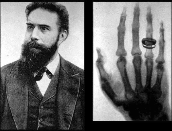 cateterdoblej's tweet photo. El 08/11/1895 Wilhelm Conrad Roentgen, mientras experimenta, se da cuenta de que por medio de un tipo de radiación es capaz de ver a través de materiales, incluyendo el cuerpo. Denomina este fenómeno "Rayos X", por la naturaleza desconocida de la radiación #DíaMundialRadiología https://t.co/msXpHRB1VI