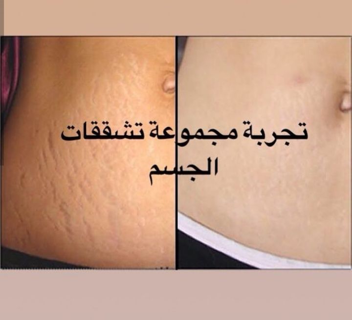 SaerSahar's tweet photo. الحل معنا
#السعودية #الأردن #الرياض #الامارات #الرياض_اليوم #قطر https://t.co/Cg0rNY6HHU