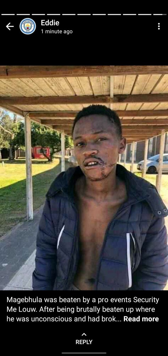 KT_Selowa's tweet photo. #BringBackAseza
He was brutally beaten by the @UWConline @SecuritasESInc  guards and the institution now wants to suspend the student for defending himself and speaking up for the student populace against its abuse https://t.co/wDzG6t5nMG