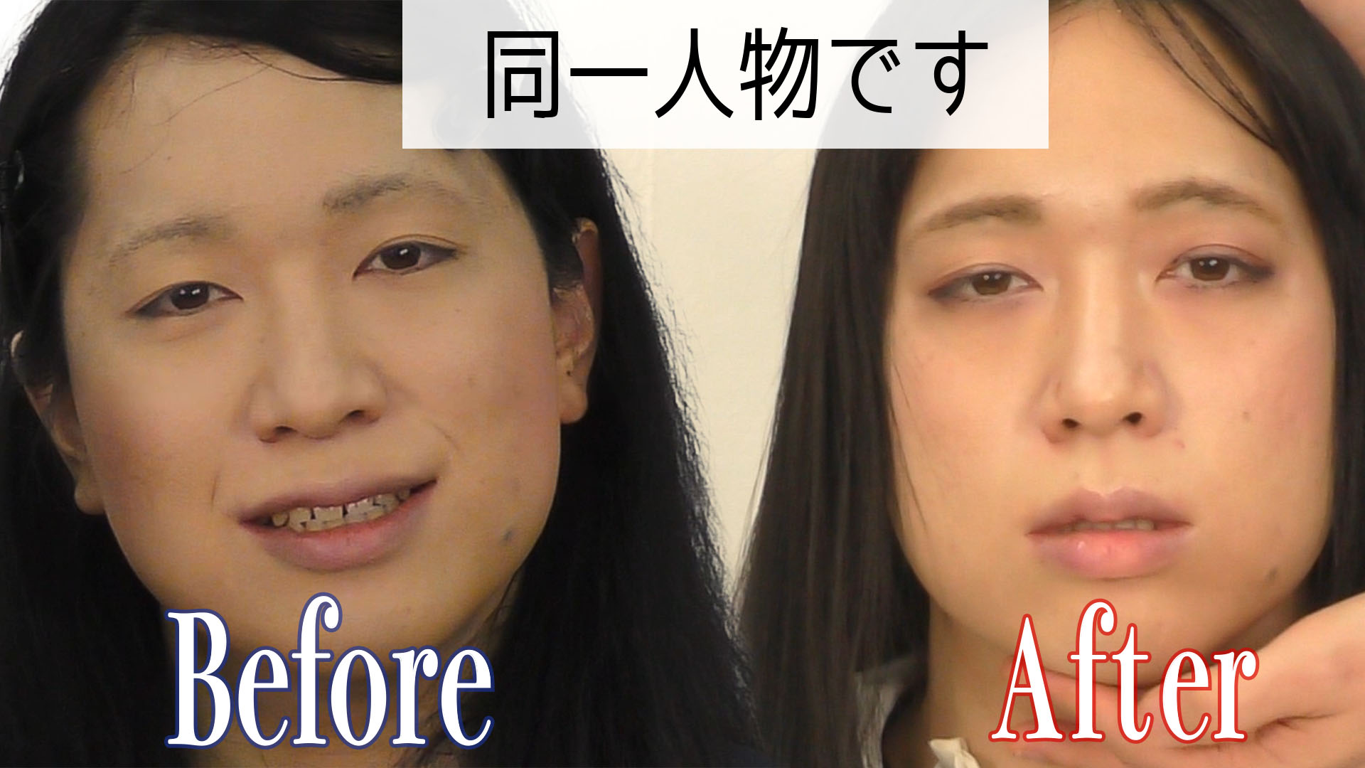 メンコス 激変 ここまで変われる メイクアップアーティストによる男の娘メイク T Co Zwrfviveui Youtubeより 女装 女装子 女装娘 男の娘 メイク コスメ 化粧男子 トランスジェンダー エックスジェンダー T Co Nk6iquw4xd メンコス 激変 ここまで変われる メイクアップアーティストによる男の娘メイク T Co Zwrfviveui Youtubeより 女装 女装子 女装娘 男の娘 メイク コスメ 化粧男子 トランスジェンダー エックスジェンダー T Co Nk6iquw4xd