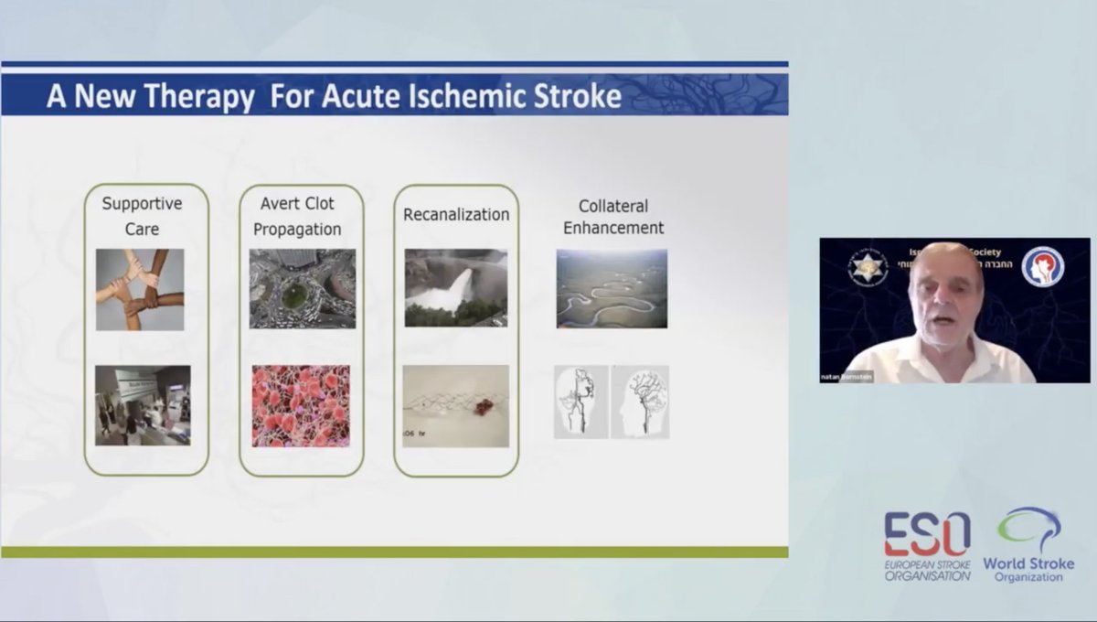 Natan Bornstein presenting Sphenopalatine Ganglion Stimulation studies for AIS, with a wonderful Steering Committe, showing a next step of stroke care: the collateral flow augmentation! Congratulations Natan #ESOWSO2020