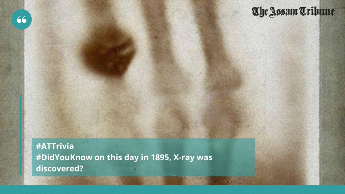 assamtribuneoff's tweet photo. #DidYouKnow on this day in 1895, Wilhelm Conrad Rontgen discovered X-rays. The first X-ray image that he took was of his wife Bertha's hand.
#TheAssamTribune #XRayDiscovery #ATTrivia https://t.co/SfNfiBr9lH