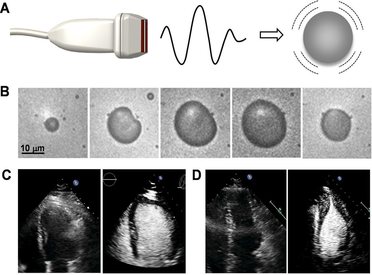 Heart_BMJ's tweet image. Really good article  on the application of Contrast Echo
heart.bmj.com/content/early/…