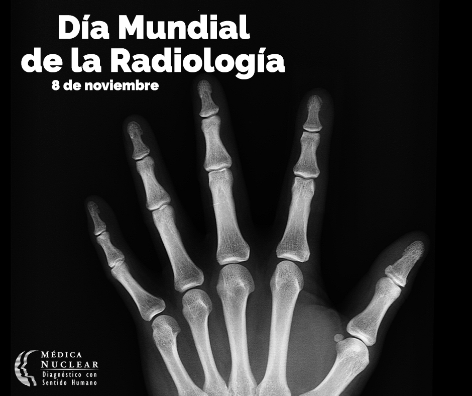 MedicaNuclear's tweet photo. Gracias a la radiología hoy en día se pueden curar fracturas, poner prótesis adecuadas a cada situación, observar la evolución y desarrollo de los fetos y poder conocer la condición real de un cerebro. #DíaMundialDeLaRadiología https://t.co/7QWVvud9xL