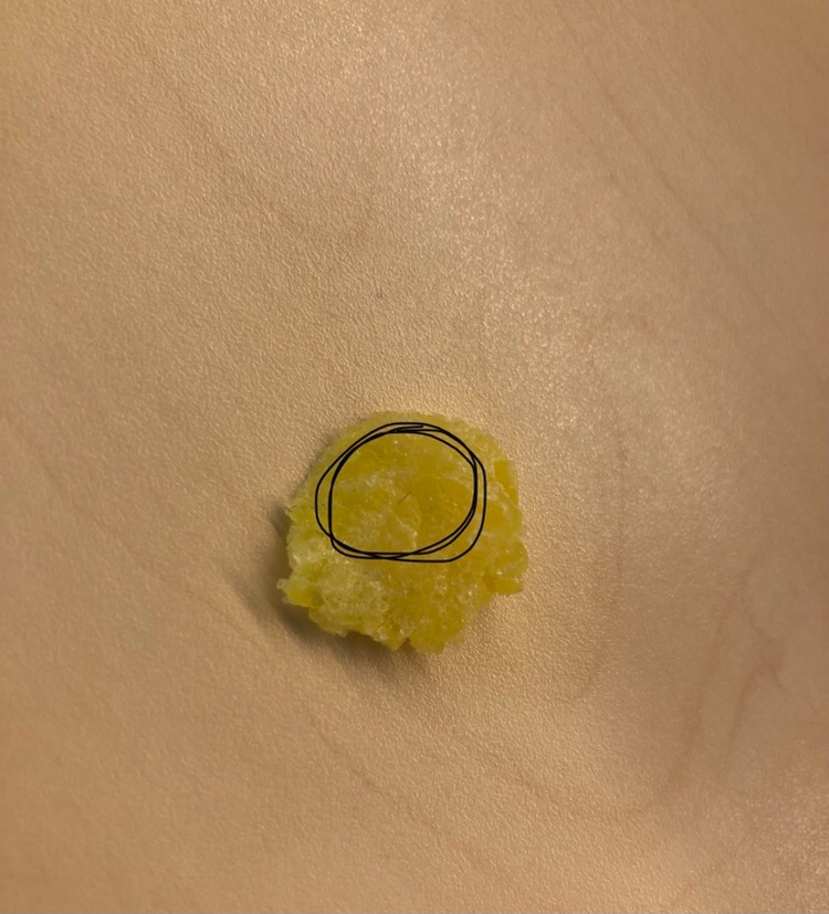 vfitzg's tweet photo. @NestleUKI what’s with the hair/dirt in this squashed (or bitten?) jelly tot I found in the bag I opened just now??😭 https://t.co/KB1dTGsz1U