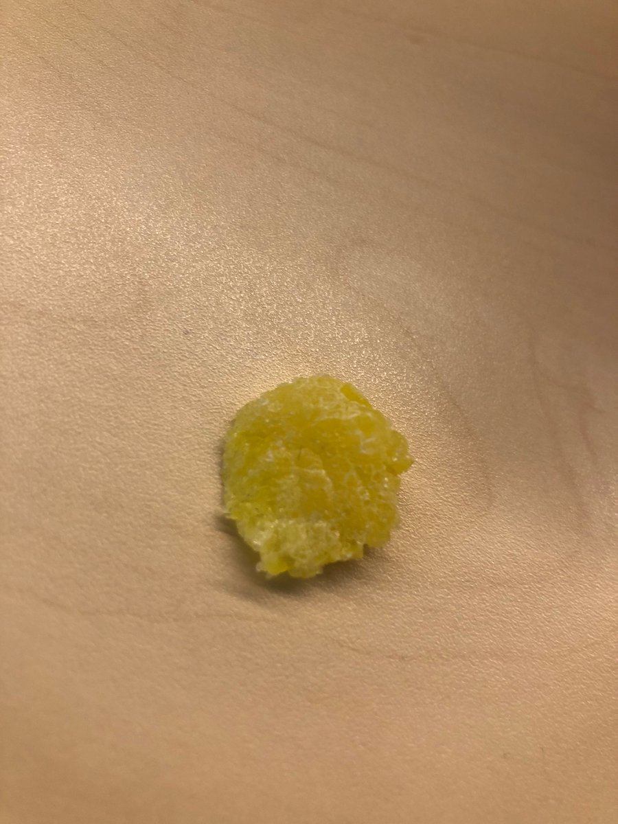 vfitzg's tweet photo. @NestleUKI what’s with the hair/dirt in this squashed (or bitten?) jelly tot I found in the bag I opened just now??😭 https://t.co/KB1dTGsz1U