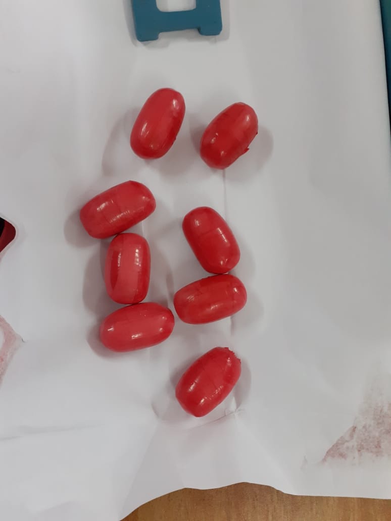 ccphqrskochi's tweet photo. Trivandrum AIU A Batch has made a seizure of 1322.67 gms of Extracted gold from three pax travelled by Emirates EK flight. The gold was concealed in their rectum.

@cbic_india 
@cgstcustvm https://t.co/O1e80AtMGk