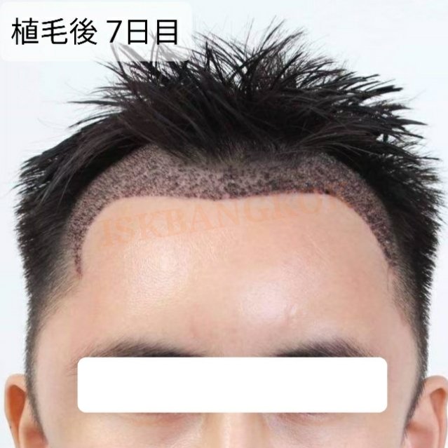 Avainsana 植毛女性 Twitterissa Avainsana 植毛女性 Twitterissa