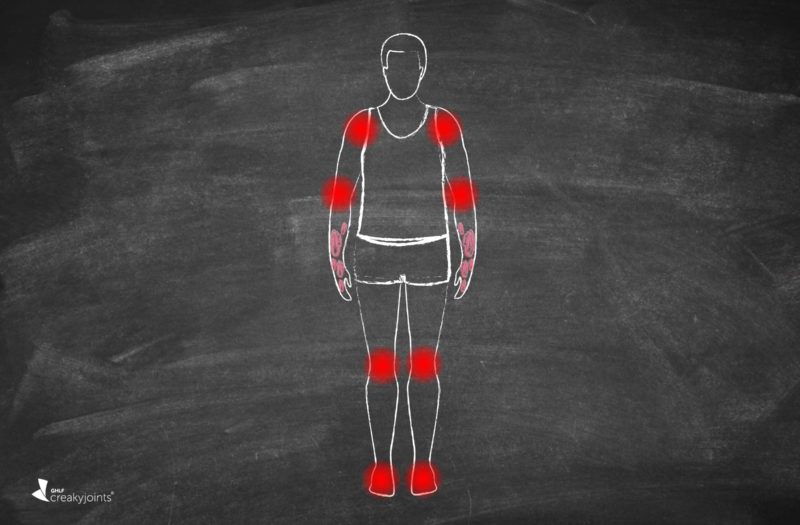 CreakyJoints's tweet photo. Functional disability means difficulty w/ daily activities (eating, getting dressed, showering, cleaning). #RA patients are significantly more likely to have this over the course of their disease, say @MyasoedovaElena @JohnDavisIII @KronzerMD + @MayoClinic researchers at #ACR20 https://t.co/QZOmHdwgrg