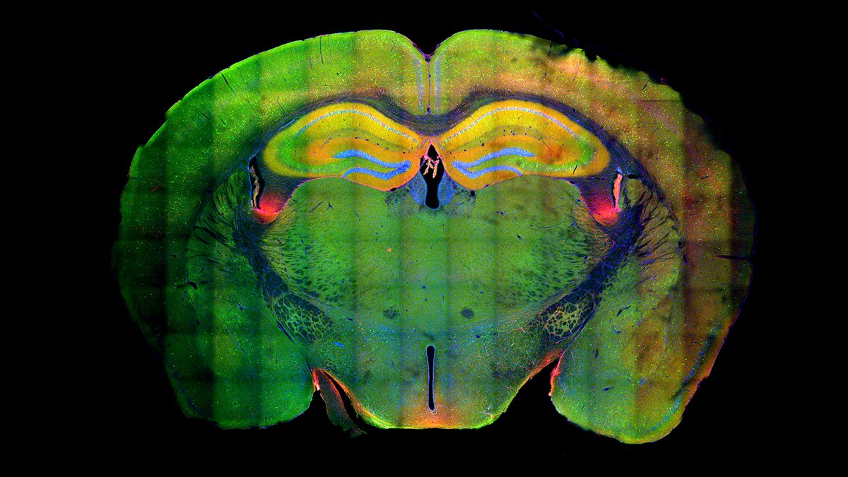 CaraSantaMaria's tweet photo. Researchers have discovered that brain cell DNA refolds itself to aid memory recall. 🧠🐭

#MouseStudy #BrainCells #DNA #Neurons #Memory #Neuroscience 

https://t.co/kJlVryQFNk https://t.co/IOLcdATL5D