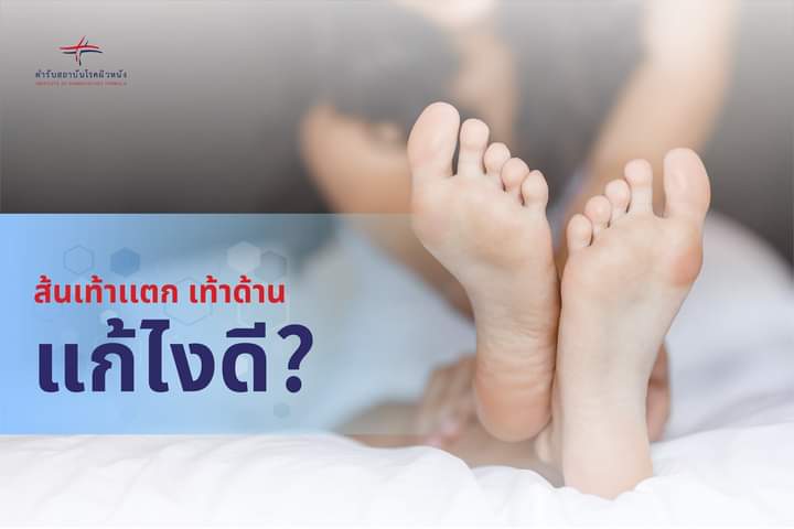 IOD_Skin's tweet photo. ส้นเท้าเเตก เท้าด้าน แก้ไงดี❓❗
อาการเท้าเเตก ด้าน มักเกิดขึ้นในช่วงหน้าหนาว  ดูแลรักษาอาการเท้าเเตก เท้าด้าน ได้โดย

01 ดื่มน้ำให้เพียงพอ เพิ่มความชุ่มชื้นในผิว
02 หลีกเลี่ยงการอาบน้ำอุ่น ทำให้ผิวสูญเสียน้ำ
03 เลือกรองเท้าที่พอดี เเละเหมาะสมกับเท้า
04 ใช้ผลิตภัณฑ์ดูแลเท้าแตก https://t.co/yagL4meShH
