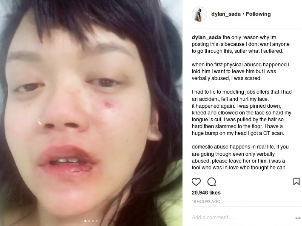 NRP1411_'s tweet photo. Gw concern banget dengan mental illness,pas baca Dylan Sada meninggal (gatau meninggalnya karena apa) tapi baca sejarahnya dia yg di siksa ayahnya,pacarnya, gw cuma mo bilang kalau guys mental illness is real, you mother fuckers! https://t.co/OhNvkVxnzr