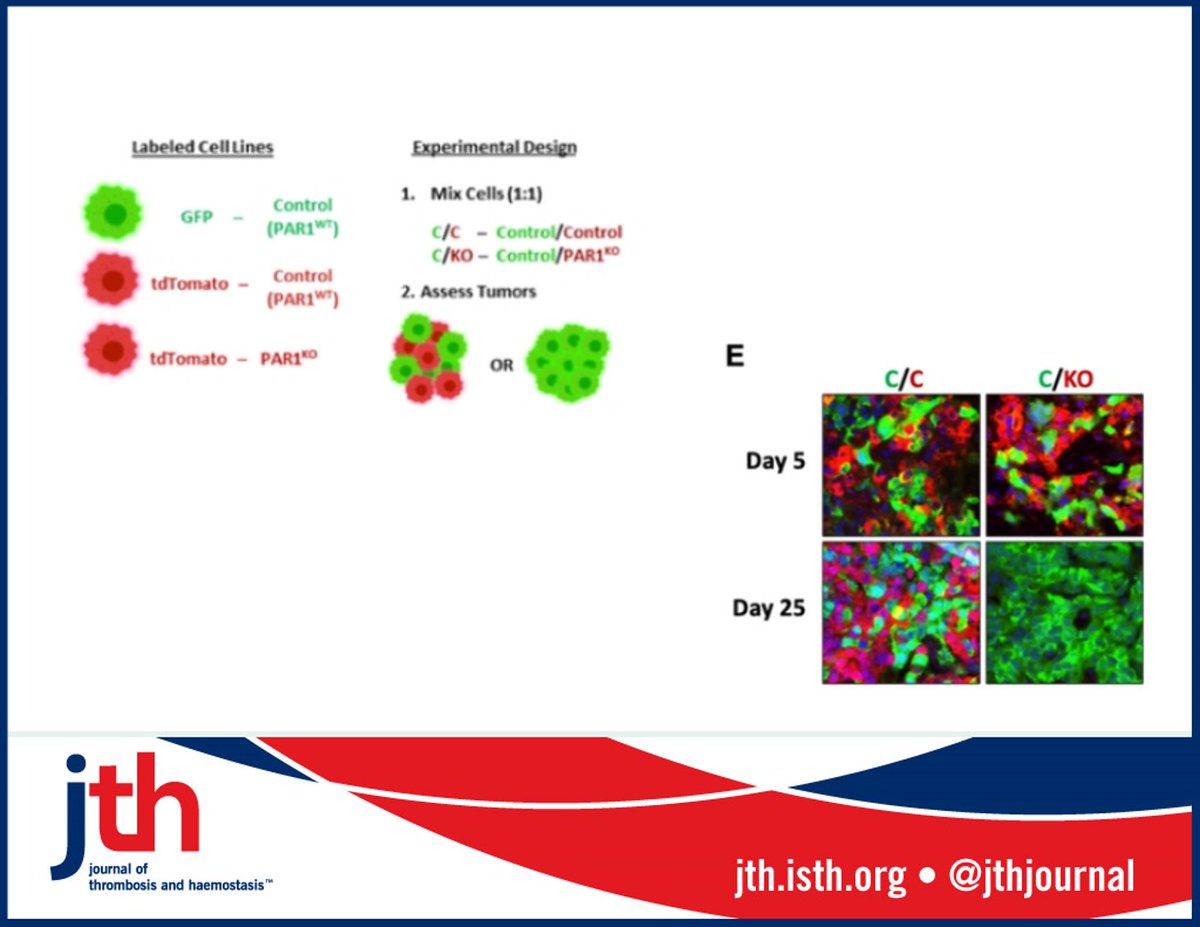 Jth New Article Pancreatic Ductal Adenocarcinoma Pdac Highly Fatal Malignancy Prothrombotic State Schweickert Et Al Fib390 396a Unc Lineberger Show Coagulation Linked To Pdac Immune Evasion Through Par1 Dependent Changes In