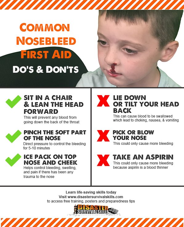 OurFavOnlineDoc's tweet photo. First Aid for Nosebleed:
•DO NOT PANIC.
Most nosebleeds are NOT serious.
•Sit/stand upright (do NOT lie down)
•Pinch tight the soft part of your nose for 10-15 minutes.
•Breathe through your mouth.
•Lean head forward. NOT backward.
•Put icepack at top of your nose.

RT pls. https://t.co/nkN6E5luKg