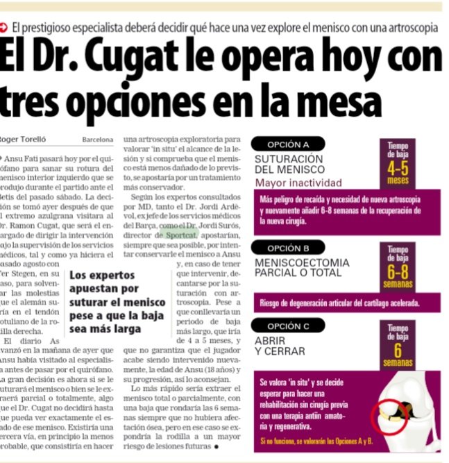 Sportcatcat's tweet photo. 📰 El @mundodeportivo, de la mà de @RogerTorello ✍️, parla novament avui en l'edició en paper de l'opinió del nostre director, el doctor @DrJordiSuros, sobre la lesió del futbolista del Barça @ANSUFATI
#sportcat #lesio #lesions #lesiones #menisc #menisco #ansufati https://t.co/xgHilf7OGq