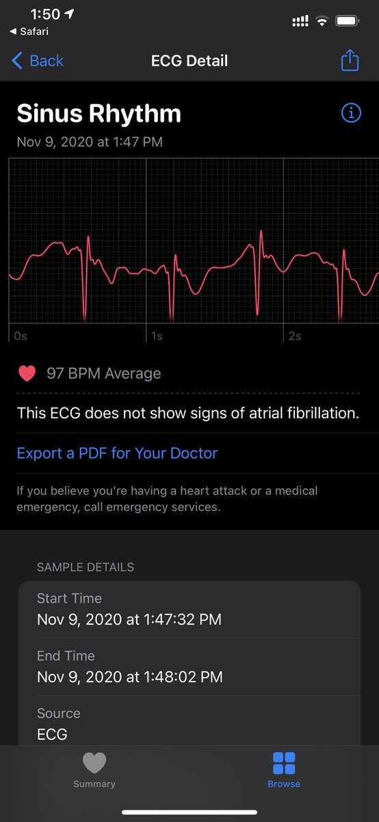 dheerapong's tweet photo. การเข้าไปซื้อของใน DutyFree วันนี้คุ้มมากๆ เพราะทำให้รู้ว่า #ECG บน Apple Watch ประเทศ #Qatar สามารถใช้งานได้แล้ว ลองต่ออาทิตย์ก่อนโน้นยังใช้งานไม่ได้อยู่เลย #AppleWatchECG #การบันทึกคลื่นไฟฟ้าหัวใจ https://t.co/ktqC9DLDLI
