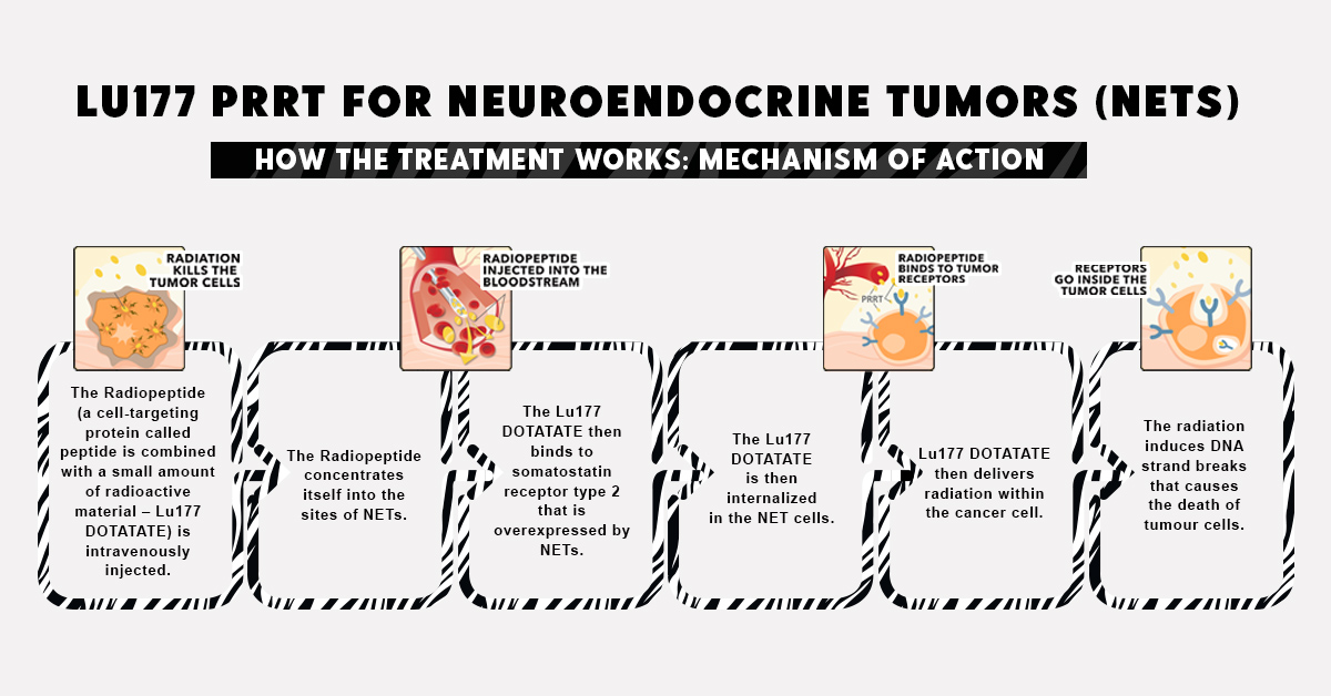 therapynuclear's tweet photo. How The Treatment Works: Mechanism Of Action for LU177 PRRT for Neuroendocrine Tumors(NETS).
https://t.co/wj0L4y2D6O
#Neuroendocrinecancer #cureNETS #Nuclearmedicinetherapy #cancertreatment https://t.co/FLp0NIIP1y