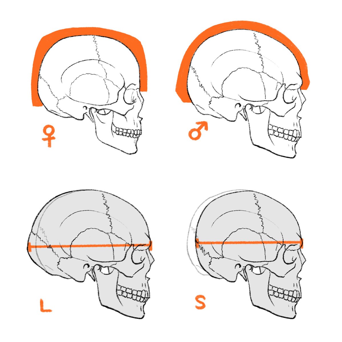 伊豆の美術解剖学者 正面から見た頭頂部のバリエーション A 頭頂部と側頭部の境界が尖っている タイプ B 頭頂部が丸いタイプ C 頭頂部が尖っているタイプ