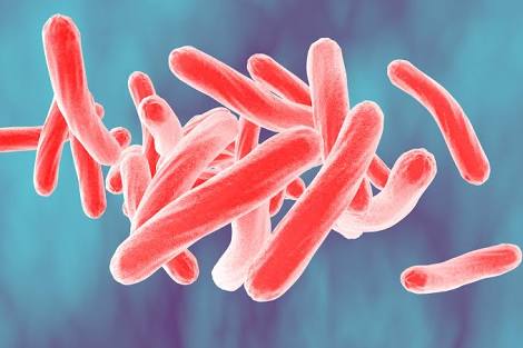 CPheyane's tweet photo. ⛔⛔⛔Mycobacterium tuberculosis (M. tb) is a species of pathogenic bacteria in the family Mycobacteriaceae and the causative agent of tuberculosis. First discovered in 1882 by Robert Koch, M.tuberculosis ⛔ https://t.co/lGLCMaSOdy