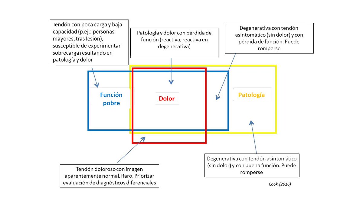 adrianescriche's tweet photo. ¿Conocíais este esquema de Jill Cook y colaboradores? En TENDINOPATÍA, hemos llegado al consenso de que para su diagnóstico requerimos de DOLOR TENDINOSO asociado a la CARGA acompañado de PÉRDIDA DE FUNCIÓN. Sin embargo, la variedad de presentaciones en clínica es muy grande(1/8) https://t.co/at9LJijDMF
