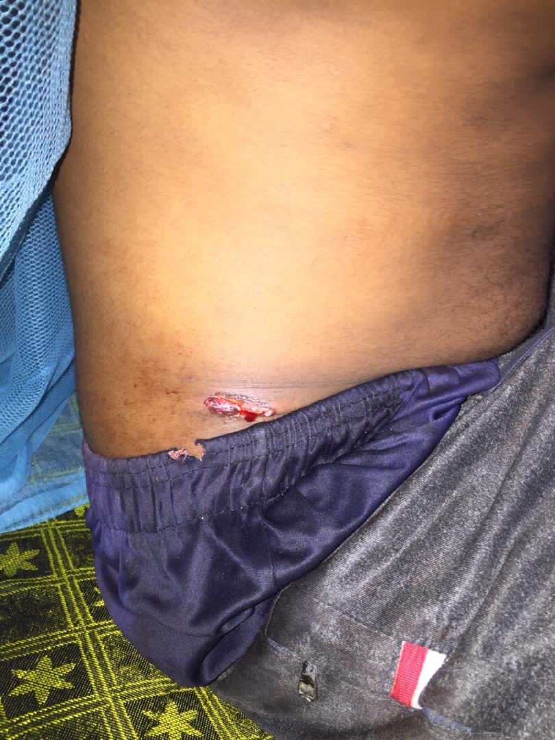 JaneRithe's tweet image. #ACTUpdates Mmoja wa majeruhi ni Kijana wa miaka 17 Abdalla Nassor Mbarouk wa Jimbo la Wingwi, Pemba. Abdallah Alipigwa Risasi ya Tumboni na Polisi akiwa nyumbani Wingwi. Kwa sasa anaendelea na Matibabu.

Unawezaje kudhuru Vijana wa Taifa lako kwa sababu ya Madaraka tu?