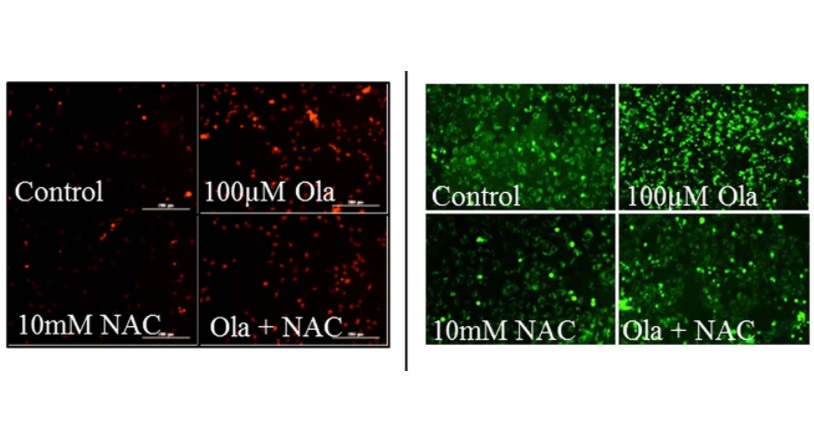 NeuralCell's tweet photo. π’ From Illawarra Health and Medical Research Institute (@ihmri):
Scientists suggest that #olanzapine may cause neurotoxicity of #HypothalamicNeurons via increased production of reactive oxygen species, mitochondrial damage, and mitophagy inhibition.
https://t.co/5edXQfqhau https://t.co/YsLpHRTFq5