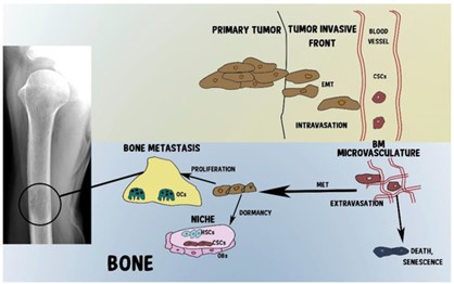 Cancers_MDPI's tweet photo. Cancer #Stem Cells, Bone and Tumor #Microenvironment: Key Players in #Bone #Metastases✅
👥by Ilaria Roato and Riccardo Ferracini
👉https://t.co/dkh5h87K5p
#bone_metastases #cancer_stem_cells #osteotropism https://t.co/RUTsj5aEW2
