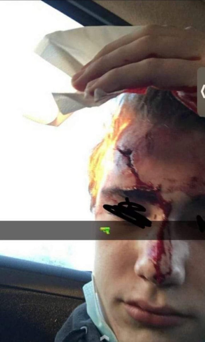 Arbola Adrien tweet media