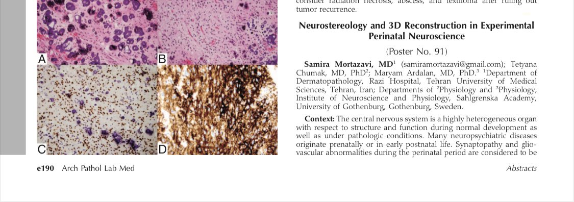 smrmrtz's tweet photo. My abstract @Pathologists #cap20virtual https://t.co/kbNbUaoEE3