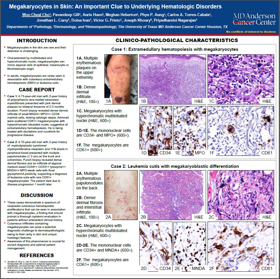 DrAldehyde's tweet image. Happy Monday. Here are 4 representative interesting (at least to me 😁) posters from MDACC being presented at #ASDP20 this year! Check them out! #ASDP2020 #dermpath #IDPath #hemepath