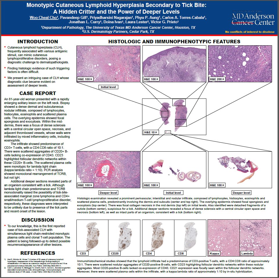 DrAldehyde's tweet image. Happy Monday. Here are 4 representative interesting (at least to me 😁) posters from MDACC being presented at #ASDP20 this year! Check them out! #ASDP2020 #dermpath #IDPath #hemepath