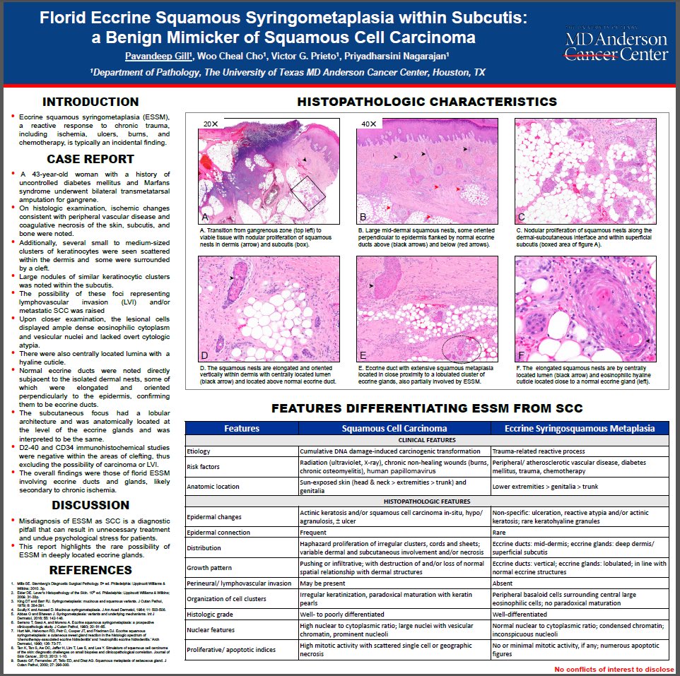 DrAldehyde's tweet image. Happy Monday. Here are 4 representative interesting (at least to me 😁) posters from MDACC being presented at #ASDP20 this year! Check them out! #ASDP2020 #dermpath #IDPath #hemepath