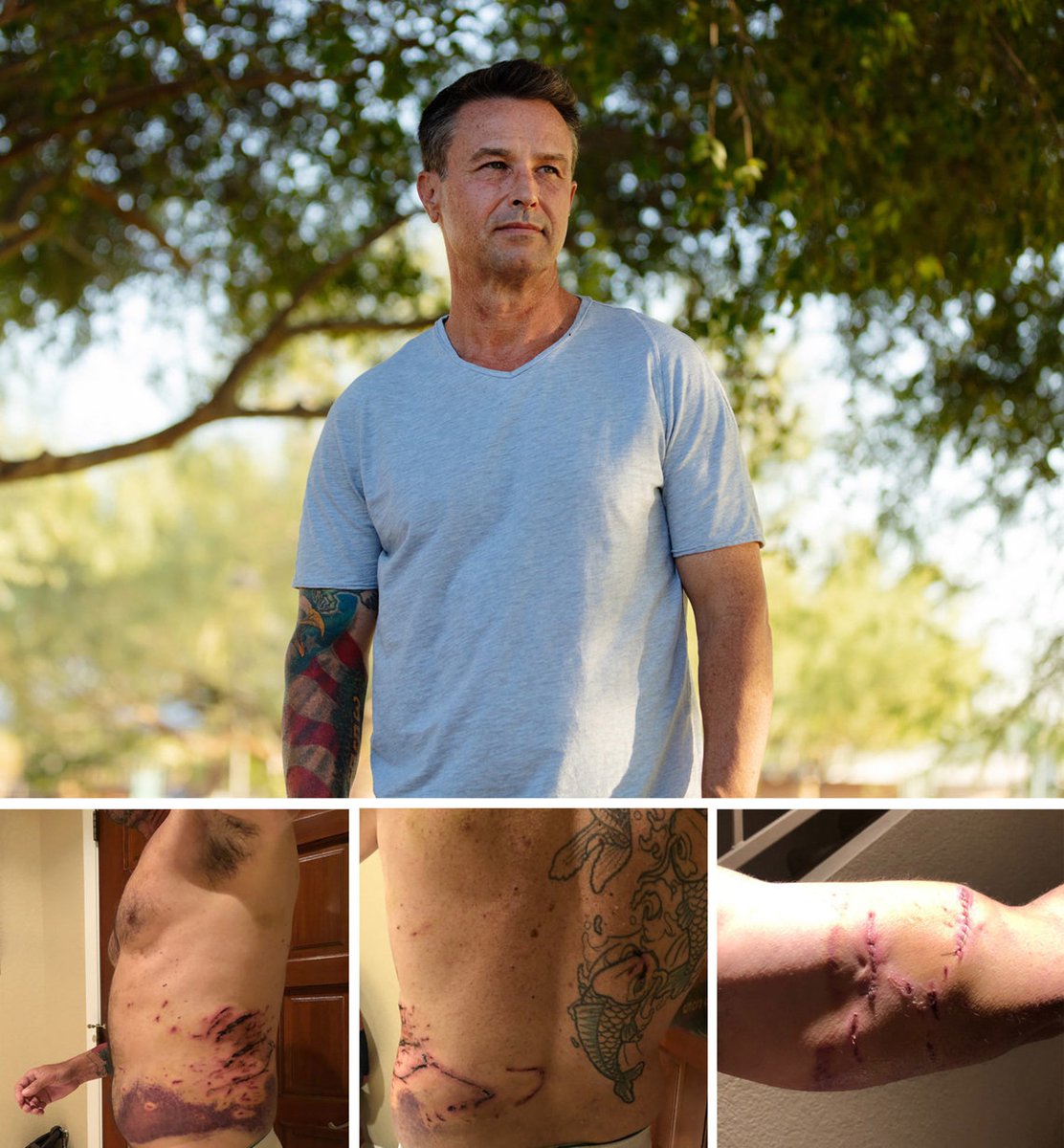 CW: Photos of recent injuries.I have to circle back: a police dog can be doing this to you, while the officer is trying to wrestle it off of you (not responding to commands), and fighting it off or crawling away is illegal.His crime?Drunkenly stealing/joyriding a golf cart.