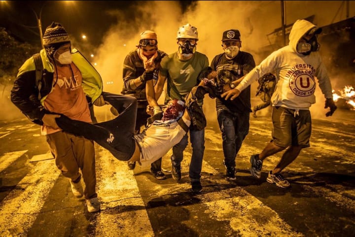 zenbruhan's tweet photo. Les pido su apoyo, ALBERTH YOSEMIR ÑAHUI PEREZ, alumno de Ceprevi, el 14 de noviembre salió a marchar para defender a su país, y fue una víctima más del salvajismo de la policía, él era parte de las personas que desactivada las bombas lacrimógenas https://t.co/IZRv0AP1EN