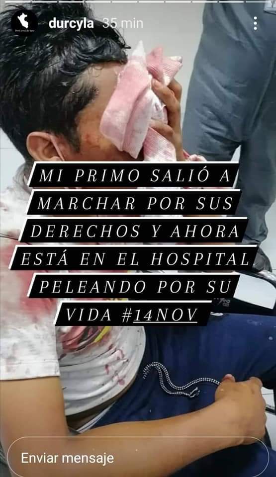 zenbruhan's tweet photo. Les pido su apoyo, ALBERTH YOSEMIR ÑAHUI PEREZ, alumno de Ceprevi, el 14 de noviembre salió a marchar para defender a su país, y fue una víctima más del salvajismo de la policía, él era parte de las personas que desactivada las bombas lacrimógenas https://t.co/IZRv0AP1EN