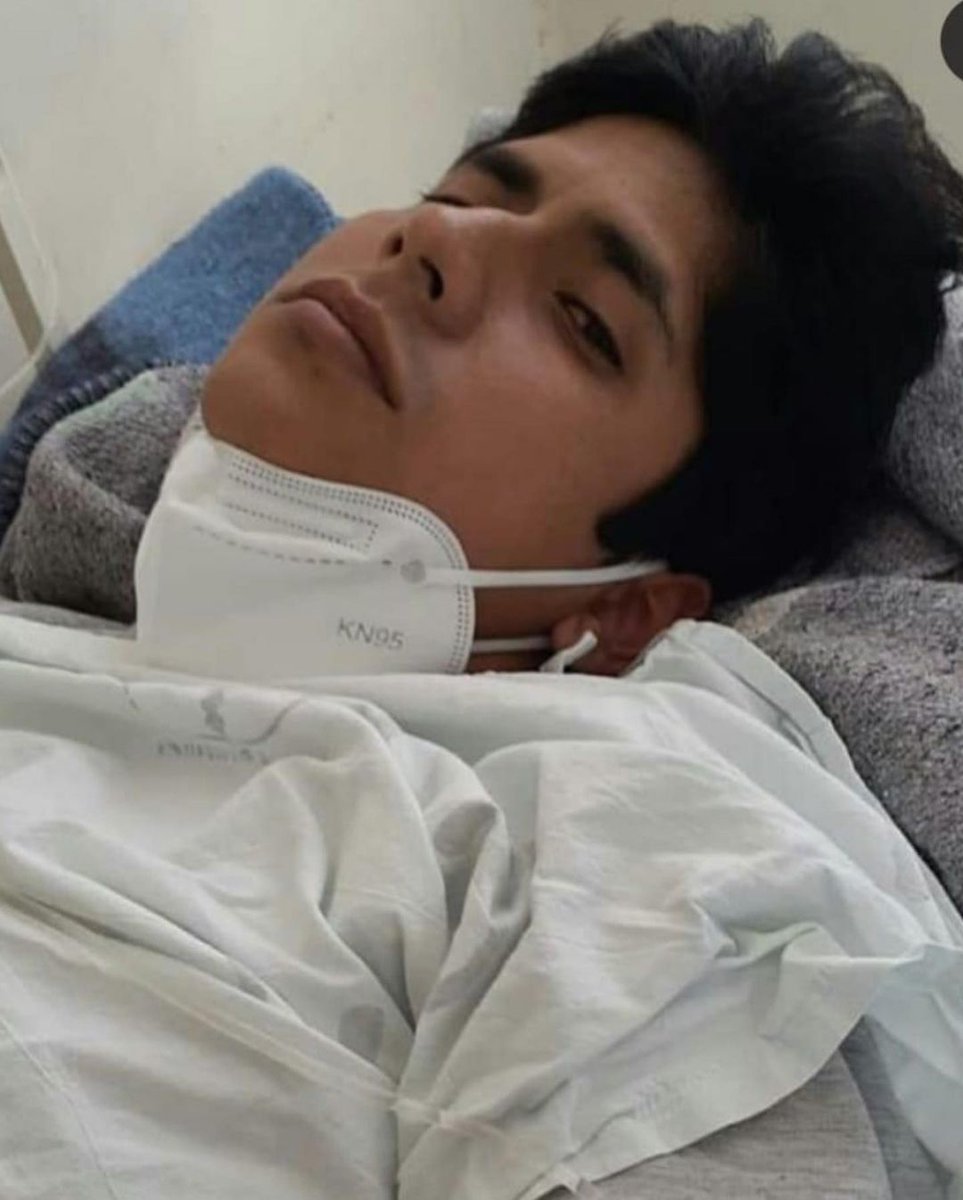 Yanarico__'s tweet photo. DIFUNDIR!!!
Jon también es un héroe. POR FAVOR, DIFUNDIR. YA NO VOLVERÁ A CAMINAR PORQUE EL PROYECTIL ATRAVESÓ SU MÉDULA. AYUDEMOS A NUESTRO COMPATRIOTA #LutoNacional #PERUVIANLIVESMATTER #FuerzaPeru #MerinoAsesino #PeruDesperto YA PUESSS #SegundaUrna Presidente del Perú https://t.co/jELxdZMH94