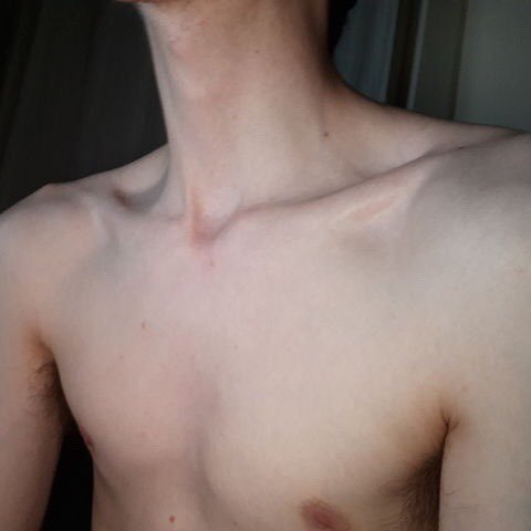 starve now, skinny later. it's so simple just don't eat and you can have everything you want!!