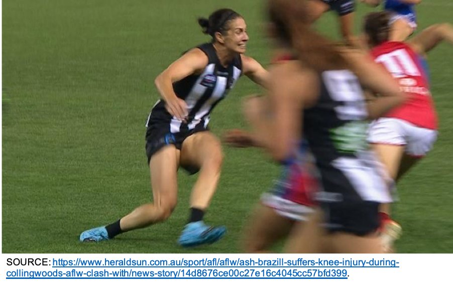 Two common AFLW ACL injury scenarios were found.

1⃣ Reactive Defending Scenario = 33% of all injuries.

Involved a player directly defending an opponent in possession of the ball, applying defensive pressure and executing a sidestep cutting movement.

#ESSTC20

3/6