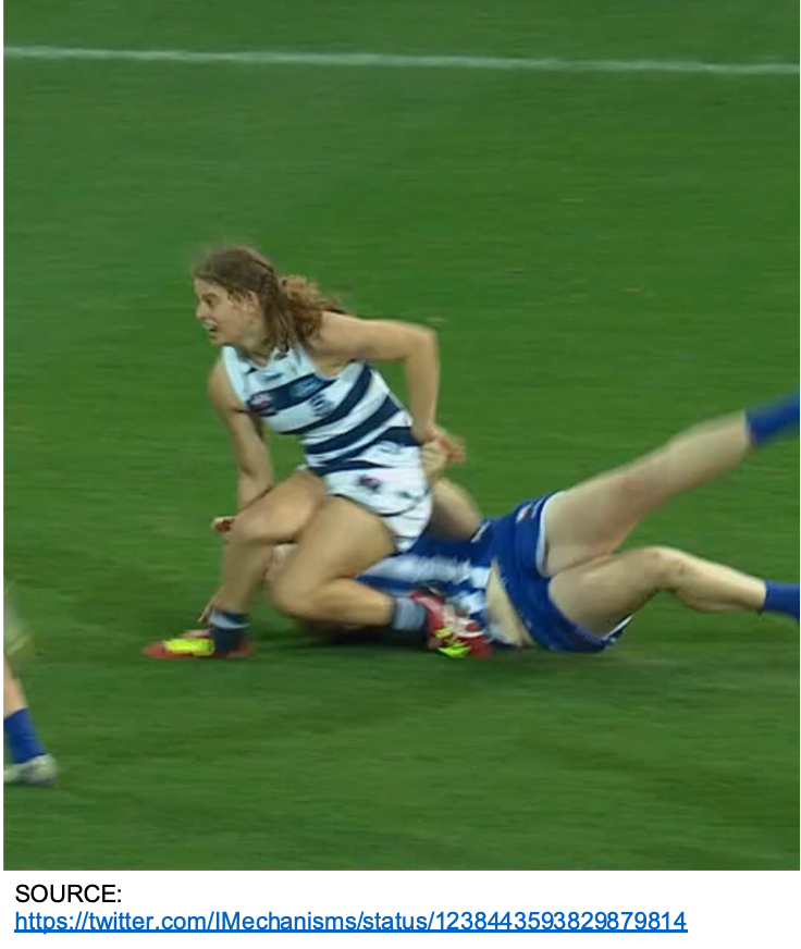 2⃣Unbalanced State Scenario = 29% of all injuries.

Injured player experienced preceding and/or indirect contact when tackled/tackling or during air or ground ball contest situations. Potentially hazardous lower limb postures were frequently seen in this scenario.

#ESSTC20

4/6