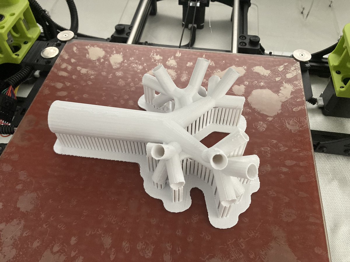 rollcagemedic's tweet photo. Hey @jducanto this tweet from 2017 randomly popped up as a like this morning.
I have a new version ready to go. More anatomically accurate. Branches in more than one plane.
And potential to add branches.
#3dprinting #SALADsim
@TBayEDguy @EMtogether @KangarooBeach @intubatiem https://t.co/FKxf21jIXX