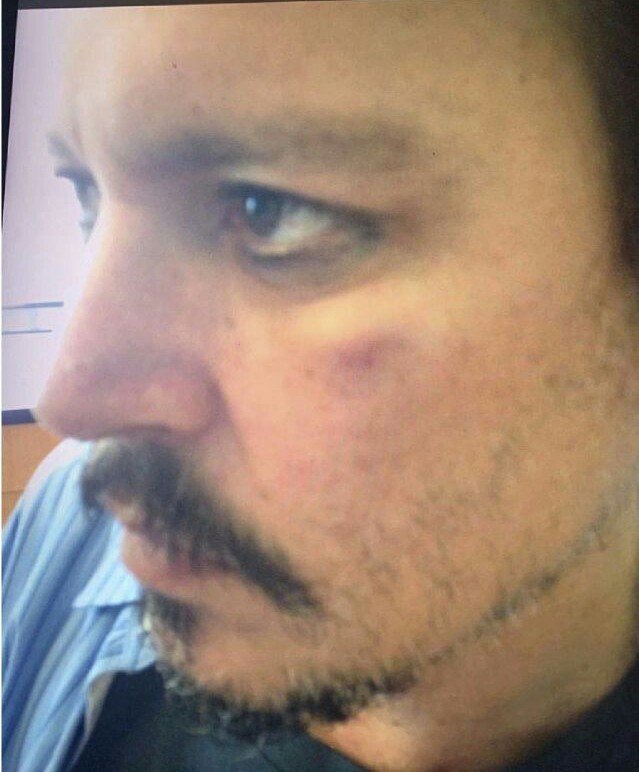 GabySara_'s tweet photo. Amber Heard denunció a Johnny Depp por violencia de género. Ahora salieron a la luz todas las evidencias donde se muestra que Depp es víctima de violencia, fotos, vídeos y audios donde ella admite haberle pegado. Es una manipuladora. 
#JusticeForJohnnyDepp #AmberHeardIsAnAbuser https://t.co/jHUBDXE9aW