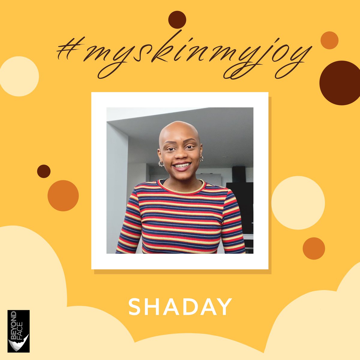 infobeyondface's tweet photo. Head over to our Instagram or Facebook page to hear Shaday’s story of joy! It’s a longer story so we are unable to post on twitter but it’s definitely worth listening to put a smile on your face 🥰 #MySkinMyJoy https://t.co/BU6scgW2gg