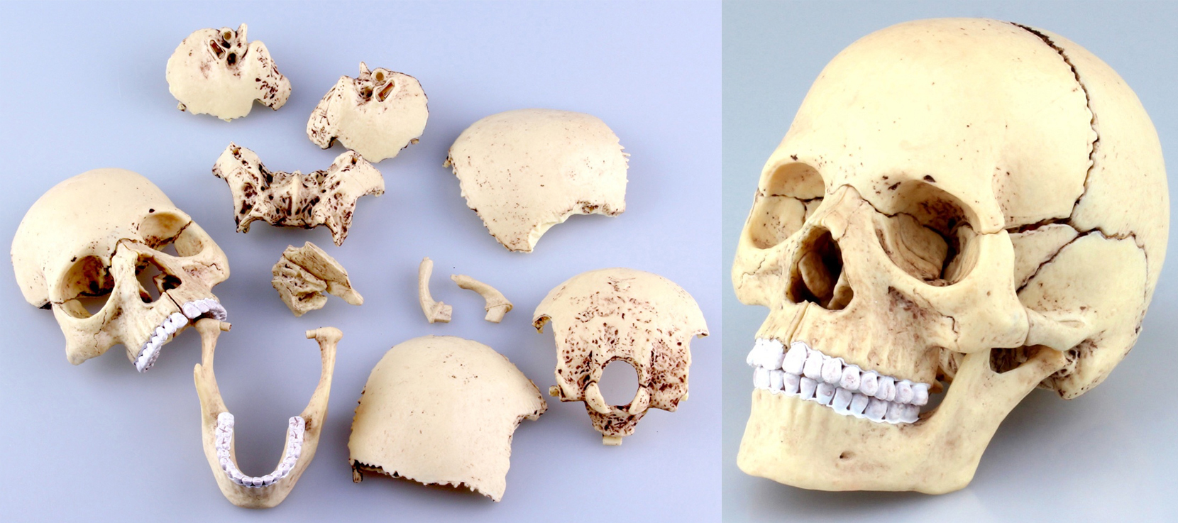 Twitter 上的 ホビーリンク ジャパン Hlj アオシマ より 立体パズル4d Visionリニューアル版登場 パズル感覚で人体内部構造を学べる 人体解剖 頭部断面解剖モデル 1 2 頭蓋骨解剖モデル 心臓解剖モデル 眼球解剖モデル デンタル解剖モデル と