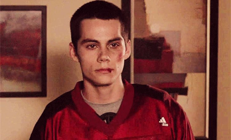 faketalesofcam's tweet photo. yo nunca diría que Stiles está sobrevalorado por que la verdad es que es el personaje más perfecto de Teen Wolf y merece toda la valoración que le damos, Stiles Stilinski supremacy https://t.co/AfSOcMJSci