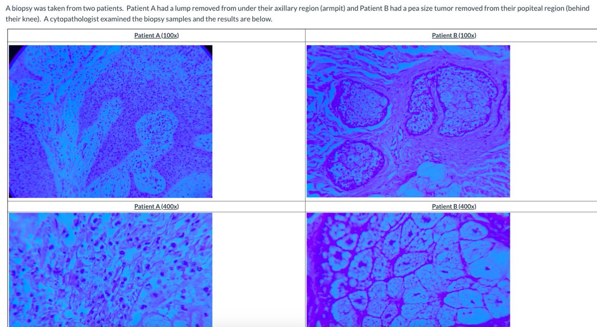 BiomedSci_JCHS's tweet photo. Nerd alert 🤓 I'm so excited about these images I took today in class as we study cytopathology.  Can you tell which patient has malignant tumor cells? By the end of the week my levels 1 will be able to explain it to ya 🔬 #PLTW  #jchslife  #RSS_CTE https://t.co/uOXZsg8dhb