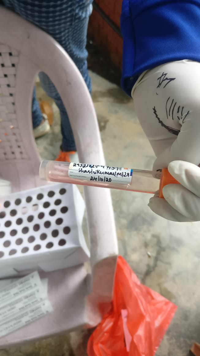 I got myself tested on the 24th of Oct and I received this text message. One of the volunteers who collected my sample told me that if my test is positive BBMP will call me otherwise I will get a text message with results within the next two days.