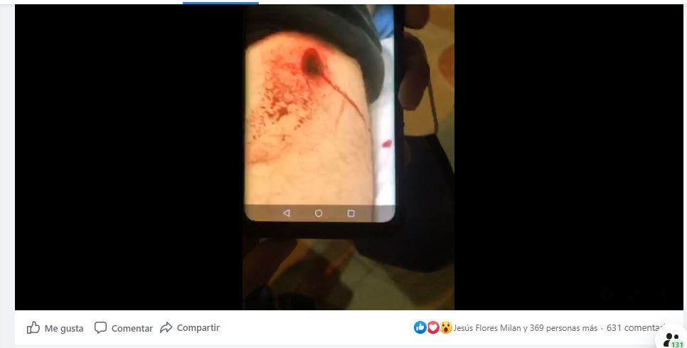 MeDicenBuho's tweet photo. Dos Reporteros heridos de bala (ambos están estables), uno más herido en la cabeza con una bala de goma, una Seguridad Pública que deja MUCHO que desear en #QuintanaRoo peor aún en #Cancún, a los hechos me remito. https://t.co/w1merwwGjU