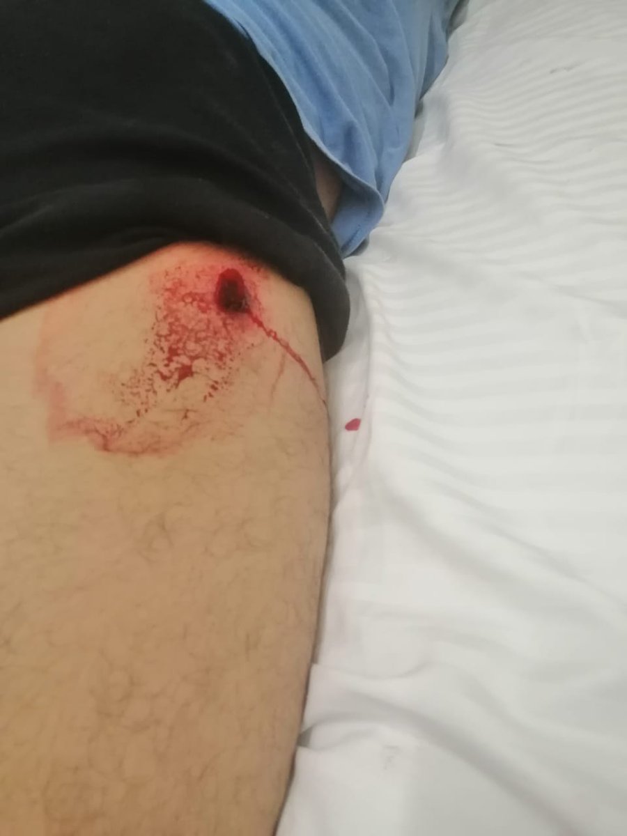 <a href="/ManotasKing/">Pornelius Hubbert</a> Aquí están sus balas de gama