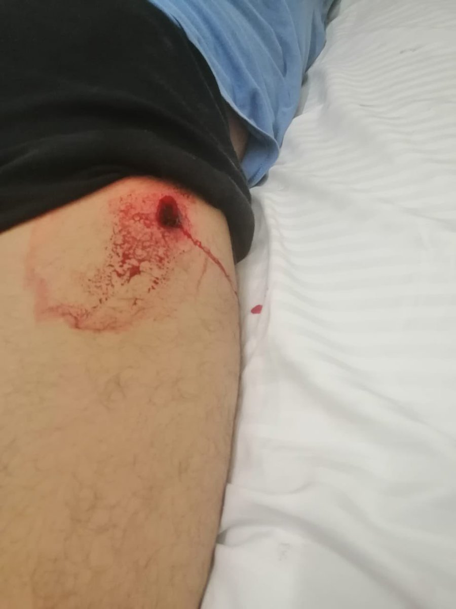 Necesito un chaleco de balas para reportear en #Cancun mi compañera estaba transmitiendo en vivo cuando la hirieron, más de una década cubriendo la fuente policiaca, la@conocían perfecto, estaba junto a ella en la marcha y ahora tiene un balazo 9 mm en la pierna